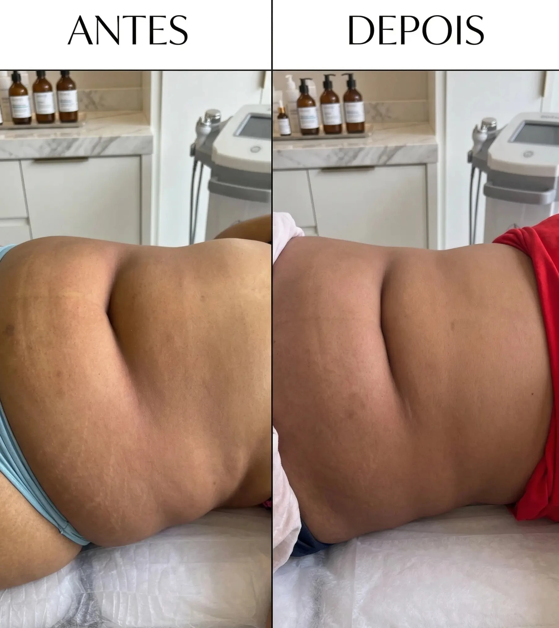 Protocolo Detox Enzima